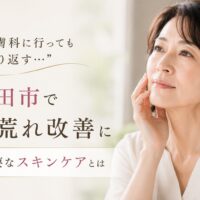 三田市で肌荒れ改善に悩む女性が、繰り返す肌トラブルとスキンケアについて考えている様子