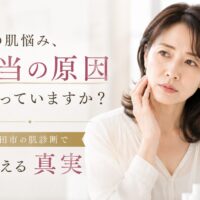三田市で肌診断を受けながら、肌悩みの本当の原因を確認する女性のイメージ画像